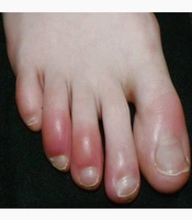  J Skin Stem Cell
