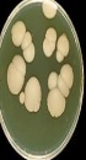 Identification of <i>Candida</i> Species Isolated from Vulvovaginal Candidiasis Patients by Polymerase Chain Reaction-Restriction Fragment Length Polymorphism (PCR-RFLP) in Yasuj Southwestern Iran