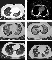 Archives of Clinical Infectious Diseases