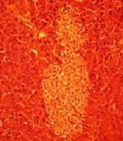  Jundishapur Journal of Natural Pharmaceutical Products