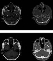 Iranian Journal of Radiology