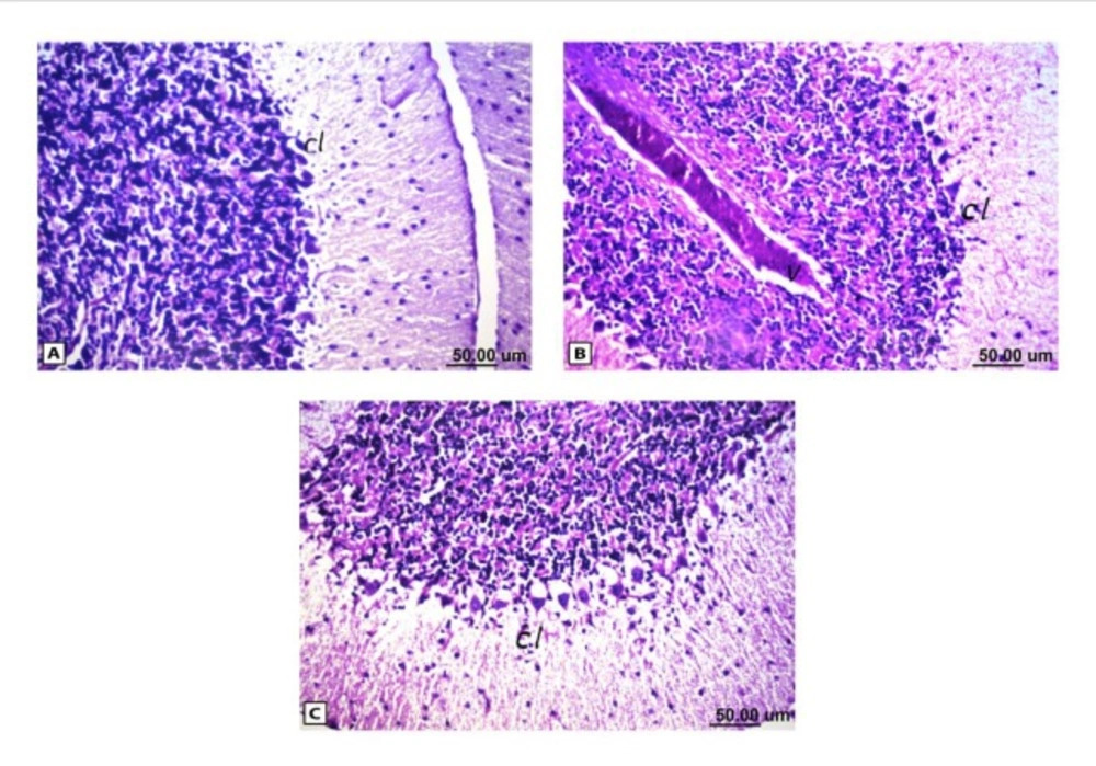Histopathological results of rat brain area of cerebellum (cl). (A) Normal control group: normal structure of cerebellum (cl).