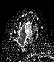 Iranian Journal of Radiology