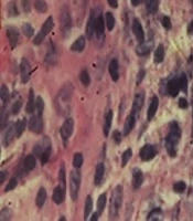 	Journal of Kermanshah University of Medical Sciences