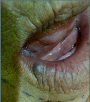 Middle East J Rehabil Health Stud