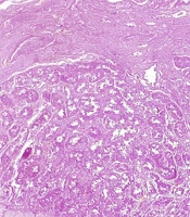 J Kermanshah Univ Med Sci