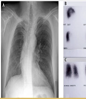 Int J Cardiovasc Pract