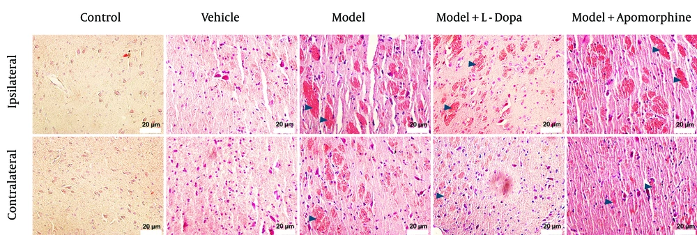 Congo red (CR) staining indicating deposition of amyloids fibril formation (dark blue arrowhead) in various groups within ipsilateral and contralateral areas of substantia nigra pars compacta (SNc). Congo red (CR) staining indicating deposition of amyloids fibril formation (dark blue arrowhead) in various groups within ipsilateral and contralateral areas of substantia nigra pars compacta (SNc).