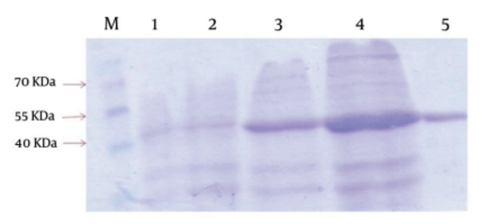 SDS-PAGE Gels With Coomassie Brilliant Blue Staining Showing the Expression and Purification of Recombinant Lysostaphin in pET 32a System The SDS-PAGE gels shows uninduced cell extract from <i>E. coli</i> BL21(DE3)+PET-lys for one hour(lane 1) and two hours (lane 2), induced cell extract for two hours(lane 3) and four hours (lane4), and Extracted Proteins after Ni-NTA affinity chromatography (lane 5). A high-range molecular weight Marker is shown on left (lane M).