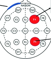 Zahedan J Res Med Sci