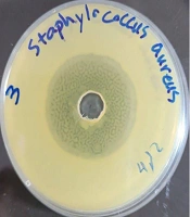 J Adv Immunopharmacol