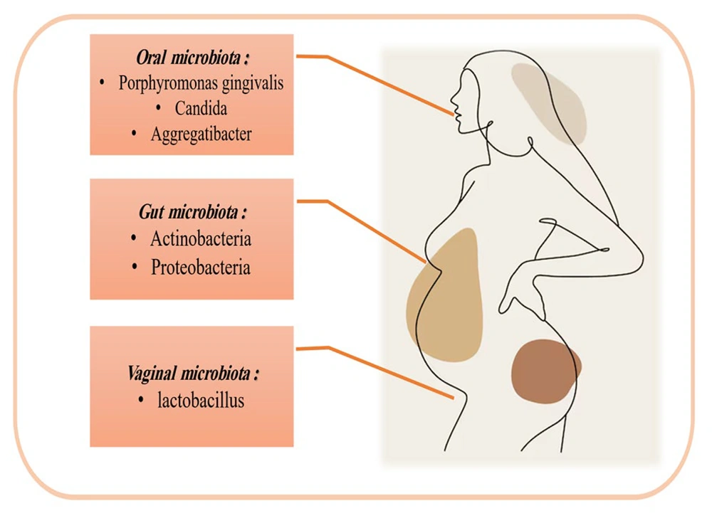 Schematic representation of pregnancy-related changes in the maternal microbiota: A pregnancy journey, noting increased abundances of <i>Porphyromonas</i>, <i>Candida</i>, and <i>Aggregatibacter</i> in the oral cavity; <i>Actinobacteria</i> and <i>Proteobacteria</i> in the gut; and <i>Lactobacillus</i> predominance in the vagina. Schematic representation of pregnancy-related changes in the maternal microbiota: A pregnancy journey, noting increased abundances of <i>Porphyromonas</i>, <i>Candida</i>, and <i>Aggregatibacter</i> in the oral cavity; <i>Actinobacteria</i> and <i>Proteobacteria</i> in the gut; and <i>Lactobacillus</i> predominance in the vagina.