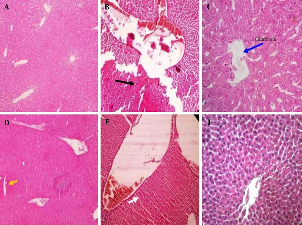 Hematoxylin and eosin (H&E) staining of the liver after different treatments in rats: A, control group with a normal structure; B, diclofenac (DIC) group (black arrow indicates necrosis); C, DIC + hydroalcoholic extract of <i>Dracocephalum kotschyi</i>40 (HEDK40) (blue arrow indicates central venous dilation); D, DIC + HEDK80 (yellow arrows indicate accumulation of edematous cells in the liver tissue and mild hepatocyte necrosis); E, DIC + HEDK120 (slight increase in the sinusoidal space); F, DIC + silymarin (SLY; with a reduction in inflammatory cell infiltration). Hematoxylin and eosin (H&E) staining of the liver after different treatments in rats: A, control group with a normal structure; B, diclofenac (DIC) group (black arrow indicates necrosis); C, DIC + hydroalcoholic extract of <i>Dracocephalum kotschyi</i>40 (HEDK40) (blue arrow indicates central venous dilation); D, DIC + HEDK80 (yellow arrows indicate accumulation of edematous cells in the liver tissue and mild hepatocyte necrosis); E, DIC + HEDK120 (slight increase in the sinusoidal space); F, DIC + silymarin (SLY; with a reduction in inflammatory cell infiltration).