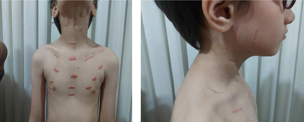 The patient after full recovery The patient after full recovery