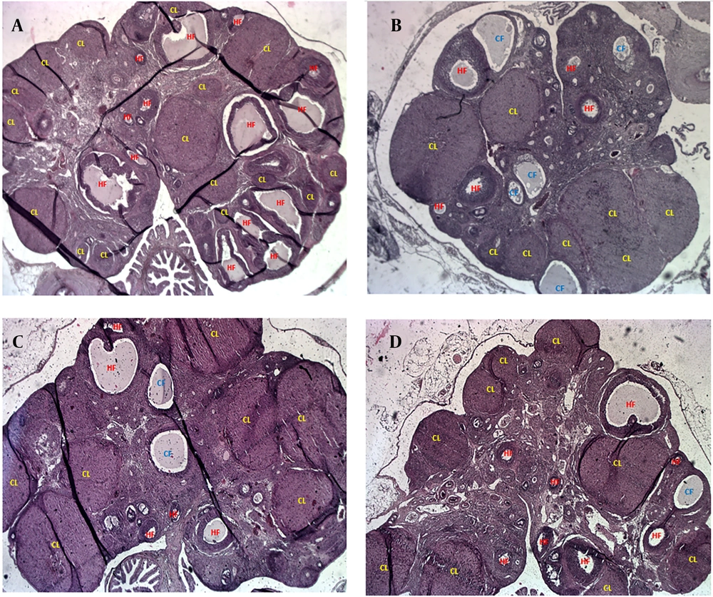 Representative histological images showing healthy (HFs), cystic follicles (CFs), and corpus luteum (CL) in ovarian tissue (magnification ×40): A, control; B, polycystic ovary syndrome (PCOS); C, 1-methyltryptophan (1-MT); D, metformin. Representative histological images showing healthy (HFs), cystic follicles (CFs), and corpus luteum (CL) in ovarian tissue (magnification ×40): A, control; B, polycystic ovary syndrome (PCOS); C, 1-methyltryptophan (1-MT); D, metformin.