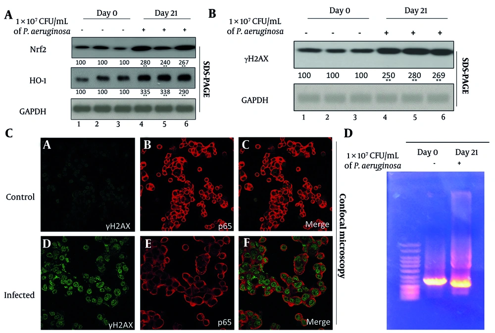 Chronic pulmonary infection induces oxidative stress and focal DNA damage in juvenile mouse lungs. A, Western blot analysis of antioxidant pathway components nuclear factor erythroid 2-related factor 2 (Nrf2) and heme oxygenase-1 (HO-1) in lung tissues from day 0 (control) and day 21 (infected) mice. GAPDH was used as a loading control. Densitometric quantification are shown below the blots from three independent blots. B , Western blot detection of γH2AX as a marker of DNA double-strand breaks in lung homogenates from the same samples. Densitometric analysis are shown below the blots. C, confocal immunofluorescence microscopy of cultured primary lung epithelial cells stained for γH2AX (green) and p65 (red) to localize DNA damage within epithelial nuclei. Representative images from control (day 0) and infected (day 21) mice are shown. D, agarose gel electrophoresis of genomic DNA extracted from control and infected lungs to assess integrity and potential fragmentation patterns. Each lane represents an individual sample from the indicated group. Chronic pulmonary infection induces oxidative stress and focal DNA damage in juvenile mouse lungs. A, Western blot analysis of antioxidant pathway components nuclear factor erythroid 2-related factor 2 (Nrf2) and heme oxygenase-1 (HO-1) in lung tissues from day 0 (control) and day 21 (infected) mice. GAPDH was used as a loading control. Densitometric quantification are shown below the blots from three independent blots. B , Western blot detection of γH2AX as a marker of DNA double-strand breaks in lung homogenates from the same samples. Densitometric analysis are shown below the blots. C, confocal immunofluorescence microscopy of cultured primary lung epithelial cells stained for γH2AX (green) and p65 (red) to localize DNA damage within epithelial nuclei. Representative images from control (day 0) and infected (day 21) mice are shown. D, agarose gel electrophoresis of genomic DNA extracted from control and infected lungs to assess integrity and potential fragmentation patterns. Each lane represents an individual sample from the indicated group.