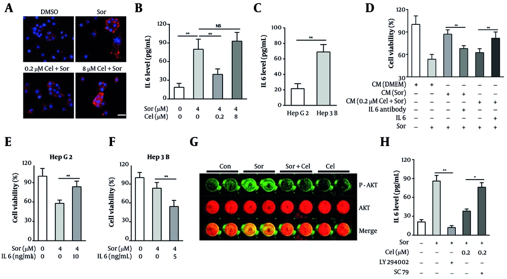 IL6 modulated the resistance of hepatocellular carcinoma (HCC) cells to sorafenib. A, tumor cells were treated with 0.4 μm sorafenib and celastrol (0.2 or 8 μm) for 24 h. The IL6 levels in the tumor cells were then determined via immunofluorescence (IF) assays (red: IL6, blue: DAPI, bar = 20 μM); B, tumor cells were treated with 0.4 μm sorafenib and celastrol (0.2 or 8 μm) for 48 h. The IL6 levels in the supernatants were then determined via ELISA assays; C, the IL6 levels in HepG2 and Hep3B cell supernatants were determined via ELISA assay; D, effects of various conditioned media (CM) containing an IL6-neutralizing antibody (1 μg/mL) or exogenous human IL6 (10 ng/mL) on HepG2 cell viability after exposure to 0.4 μm sorafenib for 72 h; E, HepG2 cells were cotreated with 0.4 μm sorafenib and exogenous human IL6 (10 ng/mL) for 72 h, and the cell viability was tested via MTT assay; F, Hep3B cells were cotreated with 0.4 μm sorafenib and an IL6 neutralizing antibody (1 μg/mL) for 72 h, and the cell viability was tested via MTT assay; G, the levels of phosphorylated and total AKT in HepG2 cells after exposure to 0.4 μm sorafenib and 0.2 μm celastrol for 12 h were determined via In-Cell-Western assay; H, effects of LY294002 (1 μg/mL) or SC79 (2 μM) on IL-6 secretion in HepG2 cells after exposure to 0.4 μm sorafenib and 0.2 μm celastrol for 24 h (abbreviations: Sor, sorafenib; cel, celastrol; NS, not significant. *P < 0.05, **P < 0.01). IL6 modulated the resistance of hepatocellular carcinoma (HCC) cells to sorafenib. A, tumor cells were treated with 0.4 μm sorafenib and celastrol (0.2 or 8 μm) for 24 h. The IL6 levels in the tumor cells were then determined via immunofluorescence (IF) assays (red: IL6, blue: DAPI, bar = 20 μM); B, tumor cells were treated with 0.4 μm sorafenib and celastrol (0.2 or 8 μm) for 48 h. The IL6 levels in the supernatants were then determined via ELISA assays; C, the IL6 levels in HepG2 and Hep3B cell supernatants were determined via ELISA assay; D, effects of various conditioned media (CM) containing an IL6-neutralizing antibody (1 μg/mL) or exogenous human IL6 (10 ng/mL) on HepG2 cell viability after exposure to 0.4 μm sorafenib for 72 h; E, HepG2 cells were cotreated with 0.4 μm sorafenib and exogenous human IL6 (10 ng/mL) for 72 h, and the cell viability was tested via MTT assay; F, Hep3B cells were cotreated with 0.4 μm sorafenib and an IL6 neutralizing antibody (1 μg/mL) for 72 h, and the cell viability was tested via MTT assay; G, the levels of phosphorylated and total AKT in HepG2 cells after exposure to 0.4 μm sorafenib and 0.2 μm celastrol for 12 h were determined via In-Cell-Western assay; H, effects of LY294002 (1 μg/mL) or SC79 (2 μM) on IL-6 secretion in HepG2 cells after exposure to 0.4 μm sorafenib and 0.2 μm celastrol for 24 h (abbreviations: Sor, sorafenib; cel, celastrol; NS, not significant. *P < 0.05, **P < 0.01).