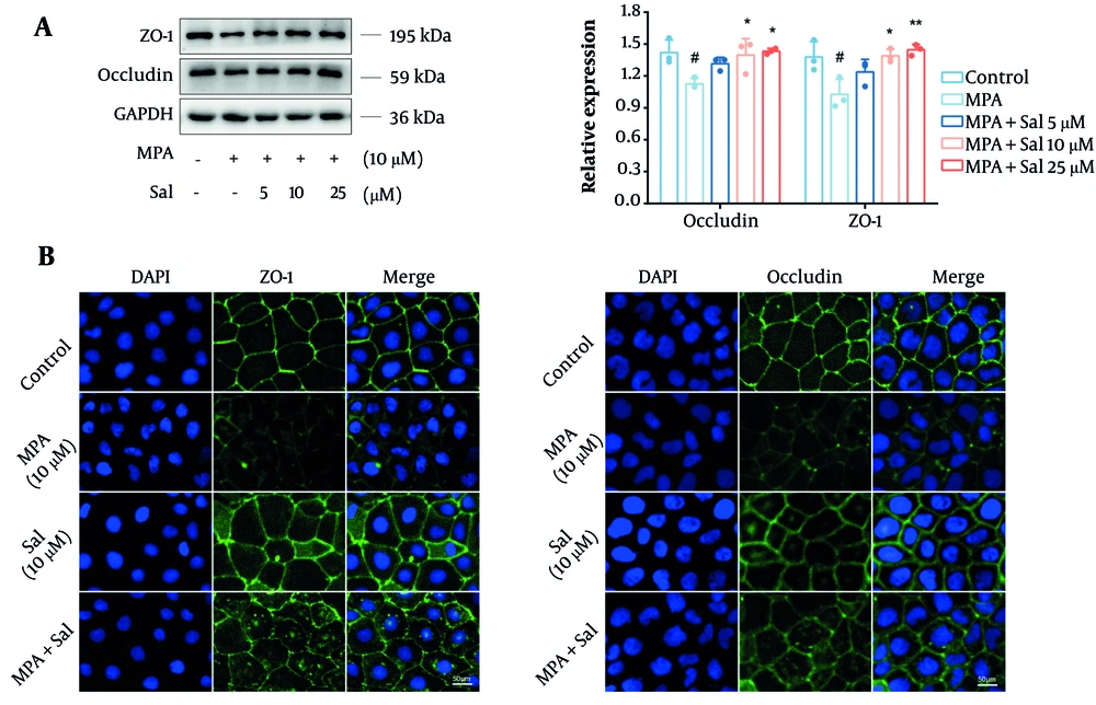 Schisanhenol (Sal) inhibited mycophenolic acid (MPA) to disrupt the tight junction (TJ) structure of Caco-2 cells. 10 μM MPA and 5, 10, 25 μM Sal were treated with Caco-2 cells for 24 hours. A and B, Western blot and immunofluorescence experiments were performed to determine the expression and distribution of occludin and ZO-1. DAPI showed blue fluorescence, occludin and ZO-1 showed green fluorescence. *, ** P < 0.05 and 0.01 were significantly different from the MPA group. # P < 0.05 significantly different from the control group. The data are shown as the mean ± SD of n = 3. Schisanhenol (Sal) inhibited mycophenolic acid (MPA) to disrupt the tight junction (TJ) structure of Caco-2 cells. 10 μM MPA and 5, 10, 25 μM Sal were treated with Caco-2 cells for 24 hours. A and B, Western blot and immunofluorescence experiments were performed to determine the expression and distribution of occludin and ZO-1. DAPI showed blue fluorescence, occludin and ZO-1 showed green fluorescence. *, ** P < 0.05 and 0.01 were significantly different from the MPA group. # P < 0.05 significantly different from the control group. The data are shown as the mean ± SD of n = 3.