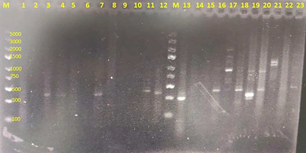 Agarose gel electrophoresis 1.5% of nested-polymerase chain reaction (PCR) products of <i>Pneumocystis jirovecii</i> partial 18SrRNA gene. Lanes 3, 4, 7, 11, 12, 16, 18, 20, and 23: Positive clinical samples having specific 330 bp bands representative of <i>P. jirovecii</i>. Lanes 1, 2, 5, 6, 8, 9, 10, 14, 15 and 22: No representative band indicating negative clinical samples. Lanes 13, 17, 19 and 21 have unspecific bands with unexpected size seen in some samples. Lanes M: A hundred bp DNA size marker. Agarose gel electrophoresis 1.5% of nested-polymerase chain reaction (PCR) products of <i>Pneumocystis jirovecii</i> partial 18SrRNA gene. Lanes 3, 4, 7, 11, 12, 16, 18, 20, and 23: Positive clinical samples having specific 330 bp bands representative of <i>P. jirovecii</i>. Lanes 1, 2, 5, 6, 8, 9, 10, 14, 15 and 22: No representative band indicating negative clinical samples. Lanes 13, 17, 19 and 21 have unspecific bands with unexpected size seen in some samples. Lanes M: A hundred bp DNA size marker.