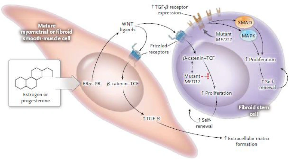 Interactions between ovarian hormones, β-catenin, and transforming growth factor beta (TGF-β) pathways, and MED12 in fibroid cells (<a href="#A164618REF15">15</a>) Interactions between ovarian hormones, β-catenin, and transforming growth factor beta (TGF-β) pathways, and MED12 in fibroid cells (<a href="#A164618REF15">15</a>)