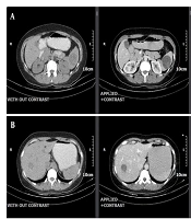 Int J Endocrinol Metab