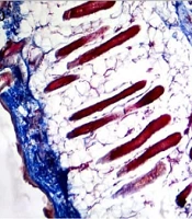 Jundishapur J Nat Pharm Prod