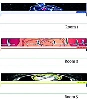 Int Cardiovasc Res J