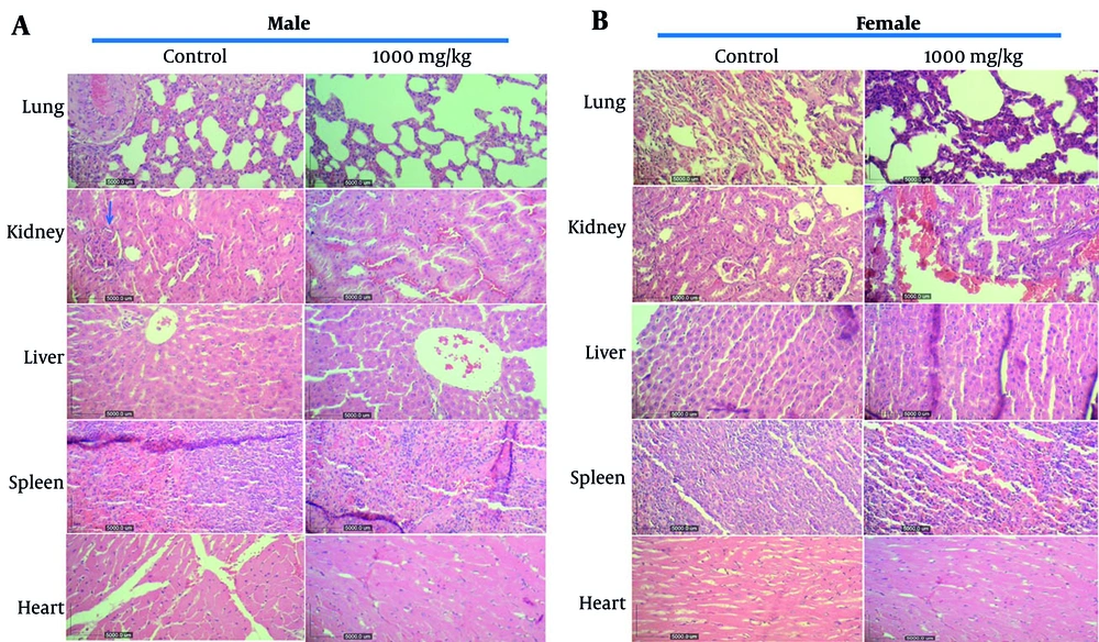 The effect of oral consumption of <i>Achillea wilhelmsii</i> extract on histological changes in tissues of the main organs of A, male; and B, female rats. Increasing the dose from 250 to 1000 mg/kg did not produce a clear dose-response trend. The presented sections are representative of lung, kidney, liver, heart, and spleen histopathology observed through hematoxylin and eosin (H&E) staining, with observations made at 10x magnification. The blue arrow in the kidney of the control male rat indicates normal tissue (unchanged glomeruli, tubules, vessels, and interstitium). The effect of oral consumption of <i>Achillea wilhelmsii</i> extract on histological changes in tissues of the main organs of A, male; and B, female rats. Increasing the dose from 250 to 1000 mg/kg did not produce a clear dose-response trend. The presented sections are representative of lung, kidney, liver, heart, and spleen histopathology observed through hematoxylin and eosin (H&E) staining, with observations made at 10x magnification. The blue arrow in the kidney of the control male rat indicates normal tissue (unchanged glomeruli, tubules, vessels, and interstitium).