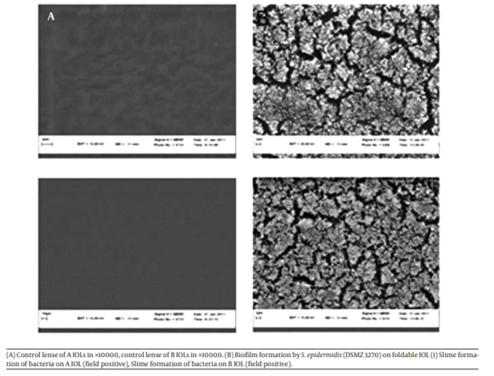 The Results of Scanning Electron Microscope (A) Control lense of A IOLs in ×10000, control lense of B IOLs in ×10000. (B) Biofilm formation by <i>S. epidermidis</i> (DSMZ 3270) on foldable IOL (1) Slime formation of bacteria on A IOL (field positive), Slime formation of bacteria on B IOL (field positive).