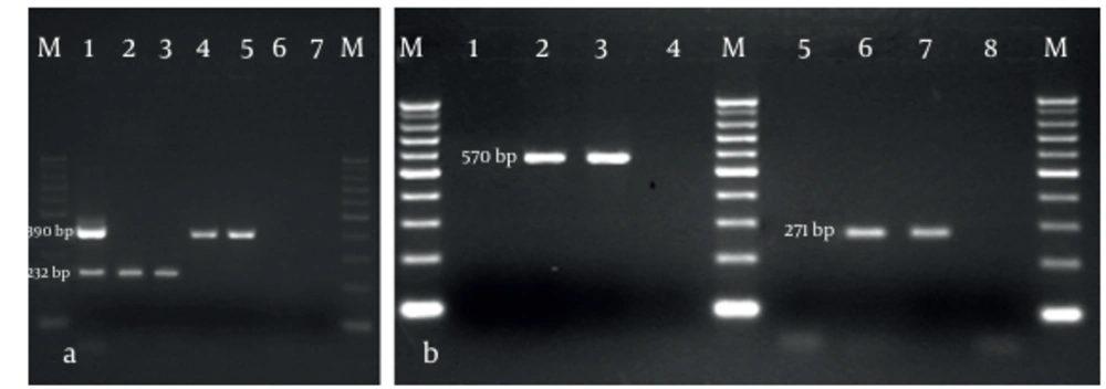 A Representative Analytical Agarose Gel for PCR Products. Part a: Multiplex PCR detection of blaIMP1 (232bp) and blaVIM2 (390bp),(lanes: M:100bp marker, 1: positive control, 2 and 3: PCR product of blaIMP1 gene, 4 and 5: PCR product of blaVIM2 gene, 6 and 7: negative controls) Part b: PCR detection of blaSIM1 (570 bp) and blaSPM1 (271 bp), (lanes: M: 100 bp marker, 1, 4, 5, and 8: negative controls, 2 and 3: positive control of blaSIM1 gene, 6 and 7: positive control of blaSPM1 gene)