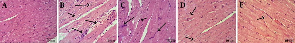 Histopathological analysis of cardiac tissues: A, control (CON): Normal architecture with striated cardiomyocytes, central nuclei, and linear fiber arrays; B, diabetic cardiomyopathy (DCM): Arrows indicate loss of striation and disrupted anastomoses; C, EA25: Similar pathology to DCM; D, EA50: Arrows indicate partial restoration of striations; E, EA100: Arrows indicate near-normal histoarchitecture with restored striations (Abbreviation: H&E, hematoxylin and eosin staining; scale bar: 10 μm; original magnification 400X). Histopathological analysis of cardiac tissues: A, control (CON): Normal architecture with striated cardiomyocytes, central nuclei, and linear fiber arrays; B, diabetic cardiomyopathy (DCM): Arrows indicate loss of striation and disrupted anastomoses; C, EA25: Similar pathology to DCM; D, EA50: Arrows indicate partial restoration of striations; E, EA100: Arrows indicate near-normal histoarchitecture with restored striations (Abbreviation: H&E, hematoxylin and eosin staining; scale bar: 10 μm; original magnification 400X).