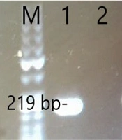 Arch Clin Infect Dis