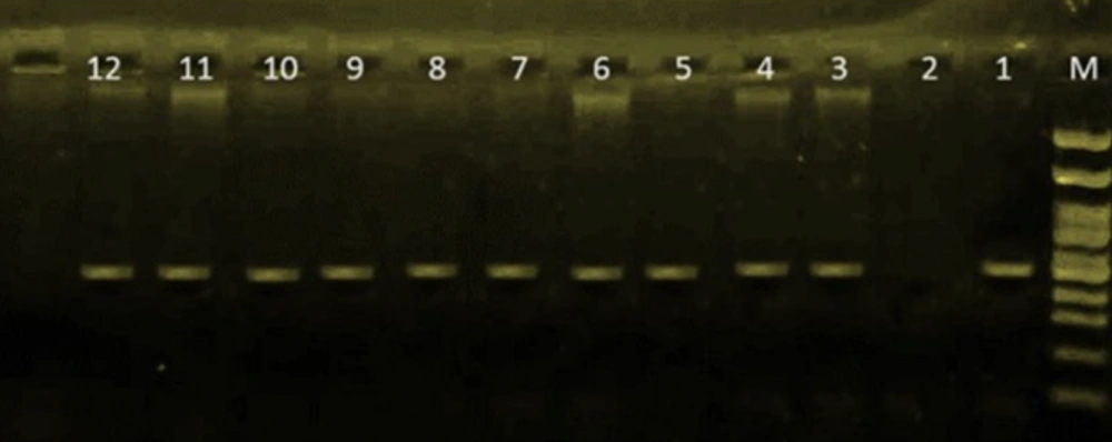 Polymerase chain reaction (PCR) amplification using <i>Pseudomonas</i> OprL primers (M: Ladder 100 bp; 1: Positive control, 2: Negative control, 3 - 10: Isolates of <i>Pseudomonas aeruginosa</i> P1 - P10) Polymerase chain reaction (PCR) amplification using <i>Pseudomonas</i> OprL primers (M: Ladder 100 bp; 1: Positive control, 2: Negative control, 3 - 10: Isolates of <i>Pseudomonas aeruginosa</i> P1 - P10)
