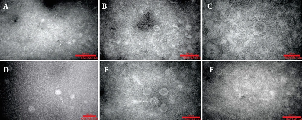 Transmission electron microscopy (TEM) was used to visualize the morphological characteristics of isolated bacteriophages (A - F). A, Phages Phps1; B, Phps2; and C, Phps3 were classified within the <i>Myoviridae</i> family (A - C), exhibiting icosahedral heads measuring approximately 85 × 80 nm, 76 × 72 nm, and 78 × 77 nm, respectively, and contractile tails of varying lengths (149 × 15 nm for Phps1, 304 × 13 nm for Phps2, and 175 × 36 nm for Phps3). In contrast, D, Phps4; E, Phps01; and F, Phps04 belonged to the <i>Siphoviridae</i> family (D - F), characterized by elongated non-contractile tails and smaller head dimensions. Specifically, Phps4 displayed a head of 55 × 51 nm with a tail of 72 × 11 nm, Phps01 had a head of 68 × 67 nm and a tail of 141 × 10 nm, while Phps04 exhibited a head of 74 × 67 nm and a tail measuring 170 × 11 nm. These structural features support the taxonomic classification and potential functional diversity of the isolated bacteriophages. Transmission electron microscopy (TEM) was used to visualize the morphological characteristics of isolated bacteriophages (A - F). A, Phages Phps1; B, Phps2; and C, Phps3 were classified within the <i>Myoviridae</i> family (A - C), exhibiting icosahedral heads measuring approximately 85 × 80 nm, 76 × 72 nm, and 78 × 77 nm, respectively, and contractile tails of varying lengths (149 × 15 nm for Phps1, 304 × 13 nm for Phps2, and 175 × 36 nm for Phps3). In contrast, D, Phps4; E, Phps01; and F, Phps04 belonged to the <i>Siphoviridae</i> family (D - F), characterized by elongated non-contractile tails and smaller head dimensions. Specifically, Phps4 displayed a head of 55 × 51 nm with a tail of 72 × 11 nm, Phps01 had a head of 68 × 67 nm and a tail of 141 × 10 nm, while Phps04 exhibited a head of 74 × 67 nm and a tail measuring 170 × 11 nm. These structural features support the taxonomic classification and potential functional diversity of the isolated bacteriophages.