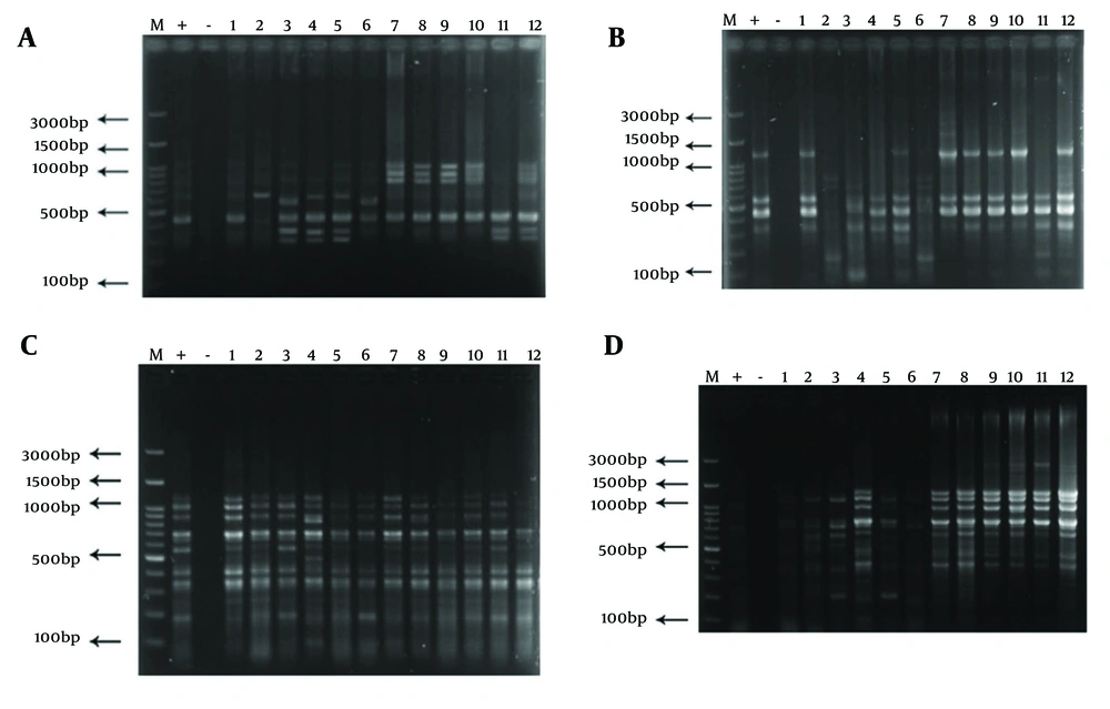 BOX-PCR genotyping of <i>Shigella</i> isolates. A, electrophoresis of BOX-PCR product for samples 1 to 12 (M: Molecular marker, +: Positive control <i>Shigella</i><i>sonnei</i> ATCC 25931, -: Negative control distilled water); B, ERIC-PCR product electrophoresis for samples 1 to 12 (M: Molecular marker, +: Positive control <i>Shigella</i><i>sonnei </i>ATCC 25931, -: Negative control distilled water); C, RAPD-PCR product electrophoresis for samples 1 to 12 (M: Molecular marker, +: Positive control <i>Shigella</i><i>sonnei </i>ATCC 25931, -: Negative control distilled water); D, Rep-PCR product electrophoresis for samples 1 to 12 (M: Molecular marker, +: Positive control <i>Shigella</i><i>sonnei </i>ATCC 25931, -: Negative control distilled water). BOX-PCR genotyping of <i>Shigella</i> isolates. A, electrophoresis of BOX-PCR product for samples 1 to 12 (M: Molecular marker, +: Positive control <i>Shigella</i><i>sonnei</i> ATCC 25931, -: Negative control distilled water); B, ERIC-PCR product electrophoresis for samples 1 to 12 (M: Molecular marker, +: Positive control <i>Shigella</i><i>sonnei </i>ATCC 25931, -: Negative control distilled water); C, RAPD-PCR product electrophoresis for samples 1 to 12 (M: Molecular marker, +: Positive control <i>Shigella</i><i>sonnei </i>ATCC 25931, -: Negative control distilled water); D, Rep-PCR product electrophoresis for samples 1 to 12 (M: Molecular marker, +: Positive control <i>Shigella</i><i>sonnei </i>ATCC 25931, -: Negative control distilled water).