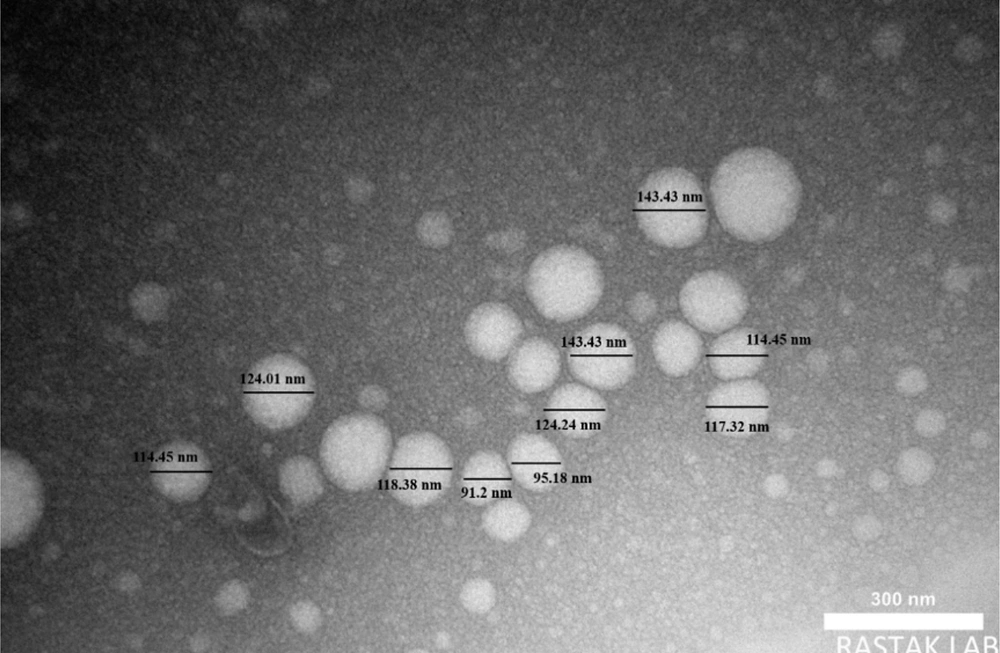 The transmission electron microscope (TEM) micrograph of the prepared nano-emulsion (scale 300 nm). The transmission electron microscope (TEM) micrograph of the prepared nano-emulsion (scale 300 nm).