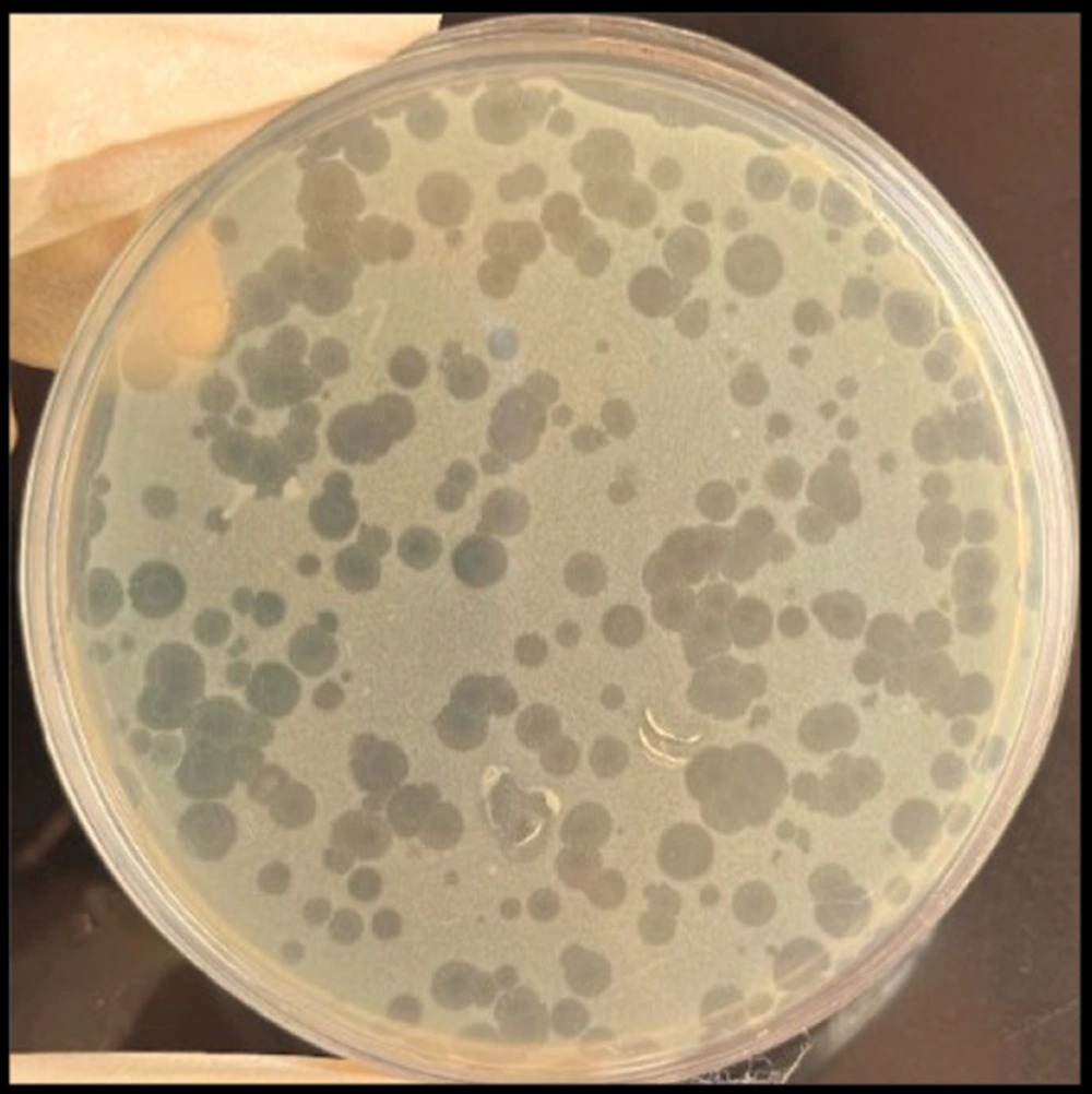Plaques of bacteriophage on double-layer agar plate Plaques of bacteriophage on double-layer agar plate