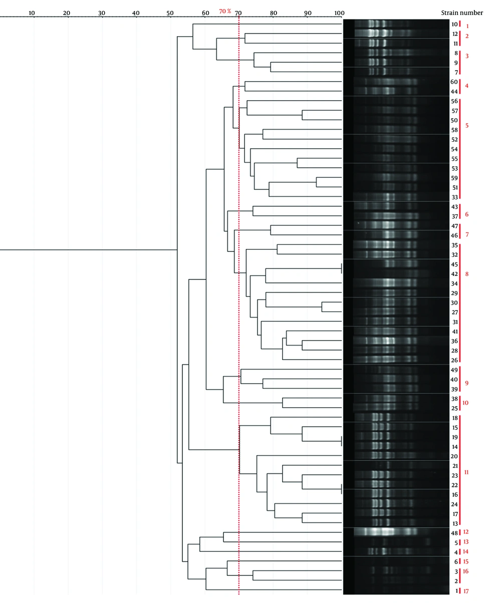 Dendrogram illustrating the genetic relatedness of <i>Shigella</i> isolates based on Rep-PCR fingerprinting. Clustering was performed at a 70% similarity threshold. The Simpson’s diversity Index (0.88) indicates the discriminatory power of this method. Dendrogram illustrating the genetic relatedness of <i>Shigella</i> isolates based on Rep-PCR fingerprinting. Clustering was performed at a 70% similarity threshold. The Simpson’s diversity Index (0.88) indicates the discriminatory power of this method.