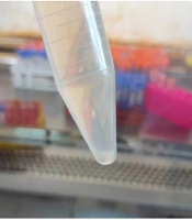 Jundishapur J Microbiol