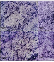 Jundishapur J Microbiol