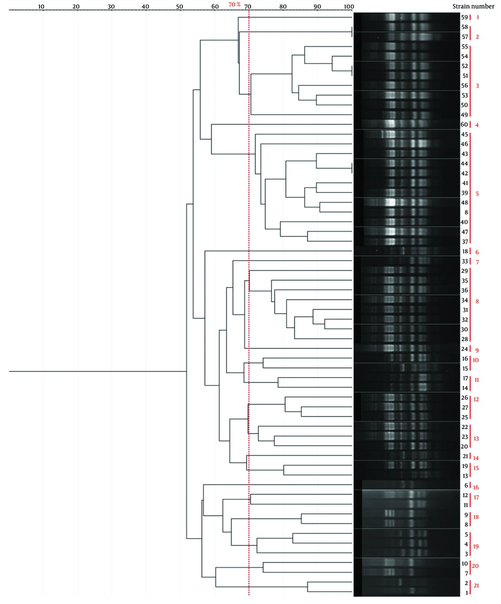 Dendrogram illustrating the genetic relatedness of <i>Shigella</i> isolates based on BOX-PCR fingerprinting. Clustering was performed at a 70% similarity threshold. The Simpson’s diversity Index (0.92) indicates the discriminatory power of this method. Dendrogram illustrating the genetic relatedness of <i>Shigella</i> isolates based on BOX-PCR fingerprinting. Clustering was performed at a 70% similarity threshold. The Simpson’s diversity Index (0.92) indicates the discriminatory power of this method.