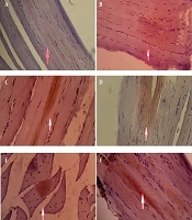 Jundishapur J Nat Pharm Prod