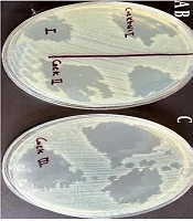 Jundishapur J Microbiol