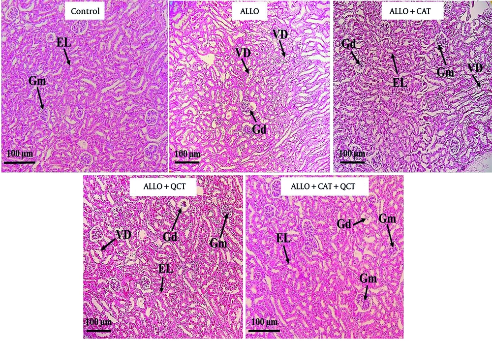 Staining of kidney tissue using hematoxylin-eosin in the control group and treatment groups. Groups consist of control, alloxan (ALLO), ALLO combined with quercetin (QCT), ALLO combined with catechin (CAT), and ALLO combined with QCT+CAT; Glomerulus (Gm), Glomerular disorganization (Gd), Epithelial lining (EL), and Vacuolar degeneration (VD). Magnification: 100X. Staining of kidney tissue using hematoxylin-eosin in the control group and treatment groups. Groups consist of control, alloxan (ALLO), ALLO combined with quercetin (QCT), ALLO combined with catechin (CAT), and ALLO combined with QCT+CAT; Glomerulus (Gm), Glomerular disorganization (Gd), Epithelial lining (EL), and Vacuolar degeneration (VD). Magnification: 100X.