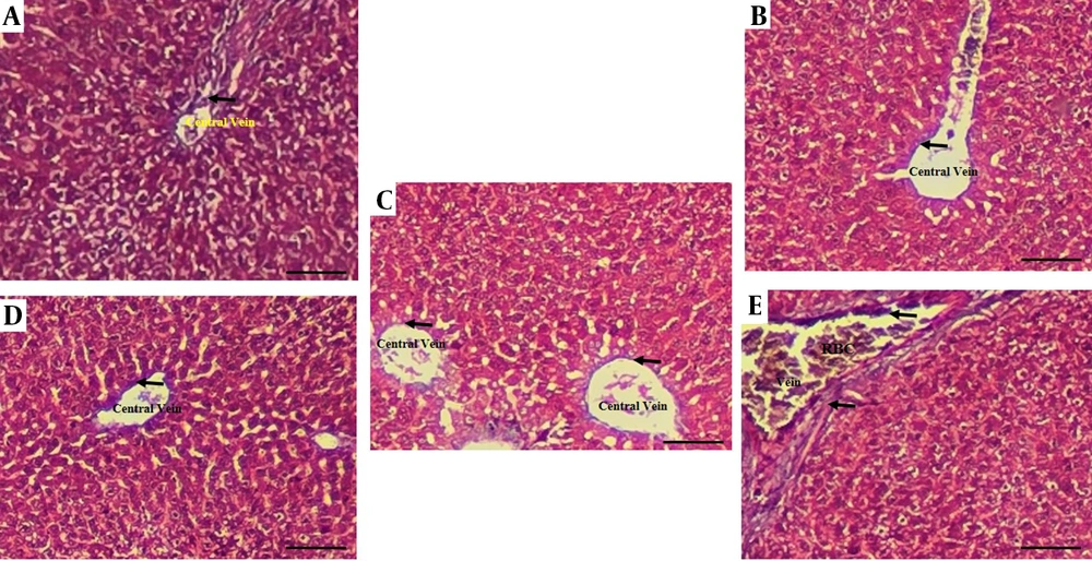Histological findings of liver tissues after Masson’s Trichrome staining (magnification 100X) in different experimental groups. A, aflatoxin-induced model (AF-induced model), B, black soldier fly larvae (BSFL) 360 (BSFL at 360 concentration); C; control: normal liver architecture; D, AF+BSFL 180 (AF-induced model treated with BSFL at 180 mg/kg concentration); E, AF+BSFL 360 (AF-induced model treated with BSFL at 360 mg/kg concentration); black arrows show collagen fibers. Histological findings of liver tissues after Masson’s Trichrome staining (magnification 100X) in different experimental groups. A, aflatoxin-induced model (AF-induced model), B, black soldier fly larvae (BSFL) 360 (BSFL at 360 concentration); C; control: normal liver architecture; D, AF+BSFL 180 (AF-induced model treated with BSFL at 180 mg/kg concentration); E, AF+BSFL 360 (AF-induced model treated with BSFL at 360 mg/kg concentration); black arrows show collagen fibers.
