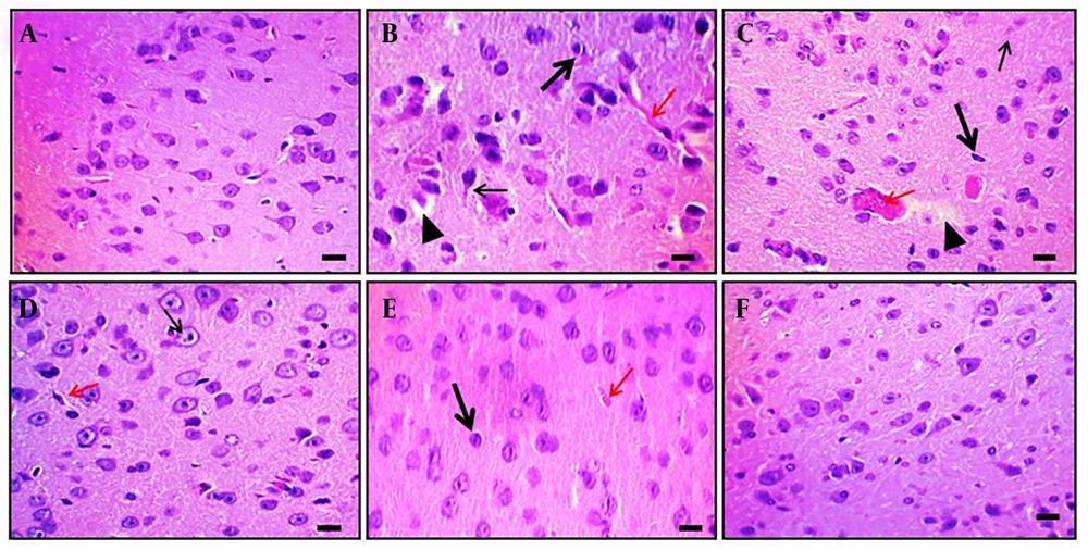 Effect of DPN on Aβ-induced histopathological changes of brain tissue in mice. Two mice were utilized in each group to evaluate the histological alterations in the brain tissue. Hematoxylin and eosin staining techniques were applied to tissue sections.A-F, histological changes of hippocampal tissue of naïve control, Aβ (4 μg; i.c.v.), DPN (40 mg/kg; for 21 days), DPN (80 mg/kg; for 21 days), DPN (120 mg/kg; for 21 days), and DP (2 mg/kg: p.o.; for 21 days) administered groups respectively. A, normal neuronal tissue structure. B, the Aβ-associated neuronal damage i.e., loss of neurons and neurofibrillary degeneration (thin arrow), nuclear pyknosis (thick arrow), vascular edema (red arrow), and vacuolation (arrowhead). C-E, the ameliorative action of DPN in a dosedependent manner against the Aβ neurotoxin. The possible neuroprotective effects of DP are depicted in F as being comparable to those of normal tissue. Microscopic analyses were
conducted with a scale bar of 35 μm and a 400× magnification.
Effect of DPN on Aβ-induced histopathological changes of brain tissue in mice. Two mice were utilized in each group to evaluate the histological alterations in the brain tissue. Hematoxylin and eosin staining techniques were applied to tissue sections.A-F, histological changes of hippocampal tissue of naïve control, Aβ (4 μg; i.c.v.), DPN (40 mg/kg; for 21 days), DPN (80 mg/kg; for 21 days), DPN (120 mg/kg; for 21 days), and DP (2 mg/kg: p.o.; for 21 days) administered groups respectively. A, normal neuronal tissue structure. B, the Aβ-associated neuronal damage i.e., loss of neurons and neurofibrillary degeneration (thin arrow), nuclear pyknosis (thick arrow), vascular edema (red arrow), and vacuolation (arrowhead). C-E, the ameliorative action of DPN in a dosedependent manner against the Aβ neurotoxin. The possible neuroprotective effects of DP are depicted in F as being comparable to those of normal tissue. Microscopic analyses were
conducted with a scale bar of 35 μm and a 400× magnification.