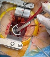 Multidiscip Cardio Annal