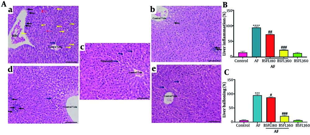 Histological evaluation of liver tissues after hematoxylin and eosin (H & E) staining (magnification 100X) and quantitative analysis of injury parameters.A, reperesentative micrographs: a, AFB1 group, b, BSFL 360 alone, c, Control, d, AFB1 + BSFL 180, e, AFB1 + BSFL 360. Yelow arrow: Balloooning degeneration; blue arrow: Sinusoidal space; red arrow: RBCs; black arrow: Inflammatory infiltration. B, quatitative analysis of lobular inflammation (%). C, quantitative analysis of hepatocyte ballooning (%). Data are expressed as mean ± SD, n = 7; * Significant difference compared with the control group (*** P < 0.001 and **** P < 0.0001). # Significant difference compared with the AFB1 group. ( # P < 0.05, ## P < 0.01, ### P < 0.001). Histological evaluation of liver tissues after hematoxylin and eosin (H & E) staining (magnification 100X) and quantitative analysis of injury parameters.A, reperesentative micrographs: a, AFB1 group, b, BSFL 360 alone, c, Control, d, AFB1 + BSFL 180, e, AFB1 + BSFL 360. Yelow arrow: Balloooning degeneration; blue arrow: Sinusoidal space; red arrow: RBCs; black arrow: Inflammatory infiltration. B, quatitative analysis of lobular inflammation (%). C, quantitative analysis of hepatocyte ballooning (%). Data are expressed as mean ± SD, n = 7; * Significant difference compared with the control group (*** P < 0.001 and **** P < 0.0001). # Significant difference compared with the AFB1 group. ( # P < 0.05, ## P < 0.01, ### P < 0.001).