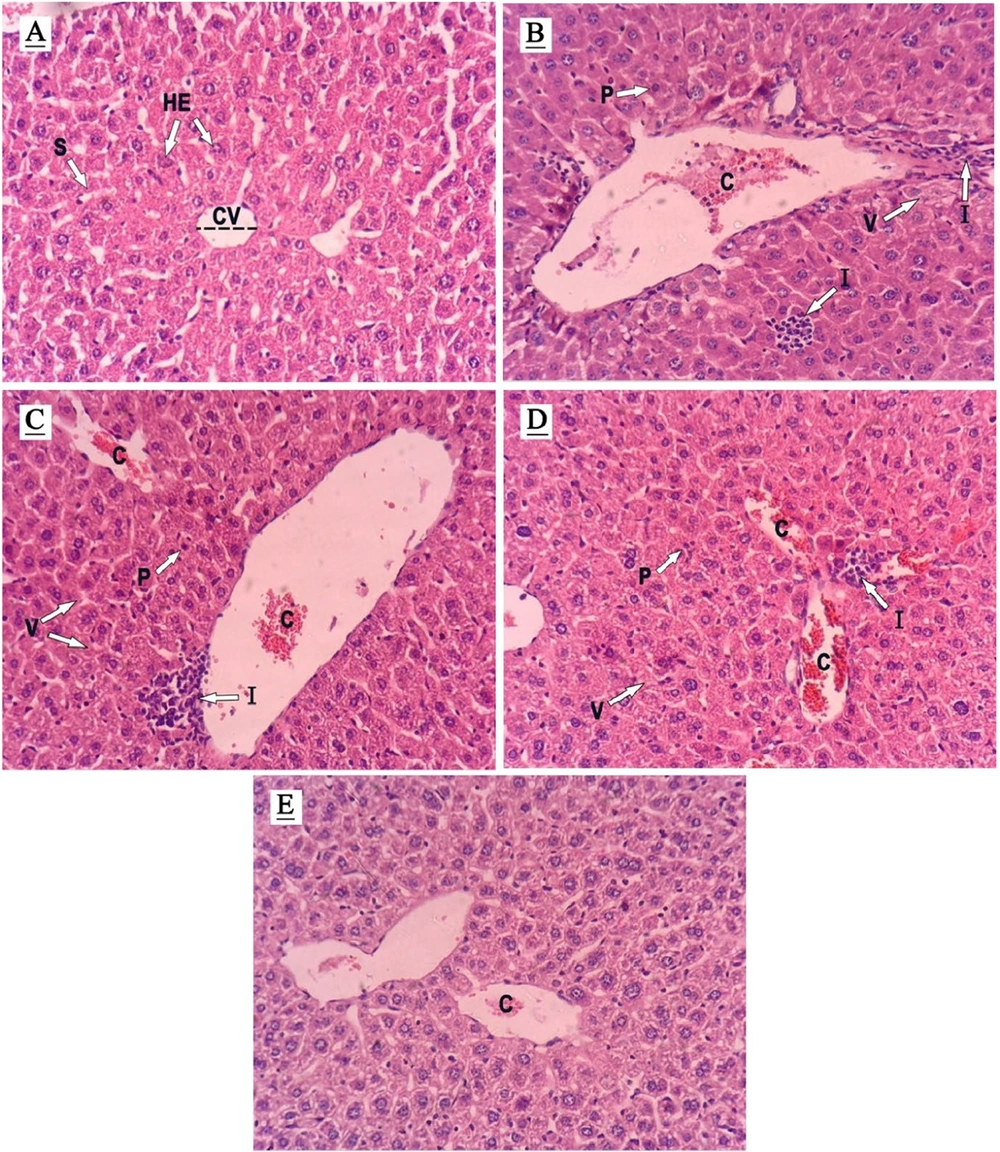 Histopathological assessment (hematoxylin and eosin- stained liver sections, Magnification ×400) demonstrating the effects of arbutin (ARB) on methotrexate (MTX)-related hepatotoxicity in liver tissue. A, controls; B, MTX group; C, MTX + ARB 25; D, MTX + ARB 50; E, MTX + ARB 100. Key: C, congestion of RBCs; CV, central vein; I, inflammatory cell infiltration; HE, hepatocyte; P, pyknosis; S, sinusoids; V, vacuolation of hepatocytes. Histopathological assessment (hematoxylin and eosin- stained liver sections, Magnification ×400) demonstrating the effects of arbutin (ARB) on methotrexate (MTX)-related hepatotoxicity in liver tissue. A, controls; B, MTX group; C, MTX + ARB 25; D, MTX + ARB 50; E, MTX + ARB 100. Key: C, congestion of RBCs; CV, central vein; I, inflammatory cell infiltration; HE, hepatocyte; P, pyknosis; S, sinusoids; V, vacuolation of hepatocytes.