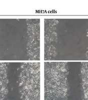Dual TYK2/JAK1 Inhibition by Brepocitinib Reprograms Synoviocyte Pathobiology: Mechanistic Insights Into Targeted Therapy for Rheumatoid Arthritis